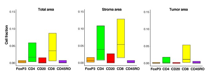 图17 肿瘤浸润淋巴细胞定量分析(Total area / Stroma are